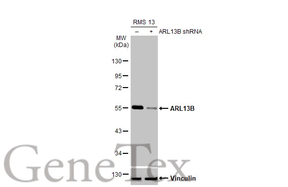 Non-transfected (–) and transfected (+) RMS 13 whole cell extract (30 μg) were separated by 10% SDS-PAGE, and the membrane was blotted with ARL13B antibody [HL2173] (GTX638177) diluted at 1:1000. The HRP-conjugated anti-rabbit IgG antibody (GTX213110-01) was used to detect the primary antibody.