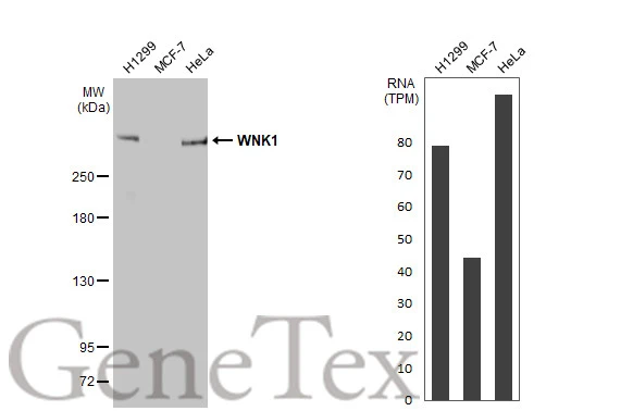 Various whole cell extracts (30 μg) were separated by 5% SDS-PAGE, and the membrane was blotted with WNK1 antibody [HL2184] (GTX638188) diluted at 1:2000. The HRP-conjugated anti-rabbit IgG antibody (GTX213110-01) was used to detect the primary antibody. Corresponding RNA expression data for the same cell lines are based on Human Protein Atlas program.