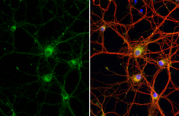 WNK1 antibody [HL2184] detects WNK1 protein at cytoplasm by immunofluorescent analysis. Sample: DIV9 rat E18 primary cortical neuron cells were fixed in 4% paraformaldehyde at RT for 15 min. Green: WNK1 stained by WNK1 antibody [HL2184] (GTX638188) diluted at 1:250. Red: Tau, an axon marker, stained by Tau antibody [GT287] (GTX634809) diluted at 1:500. Blue: Fluoroshield with DAPI (GTX30920).