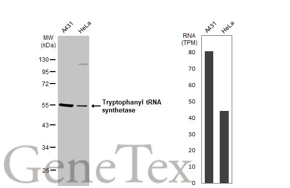 Various whole cell extracts (30 μg) were separated by 10% SDS-PAGE, and the membrane was blotted with Tryptophanyl tRNA synthetase antibody [HL2186] (GTX638190) diluted at 1:1000. The HRP-conjated anti-rabbit IgG antibody (GTX213110-01) was used to detect the primary antibody. Corresponding RNA expression data for the same cell lines are based on Human Protein Atlas program.
