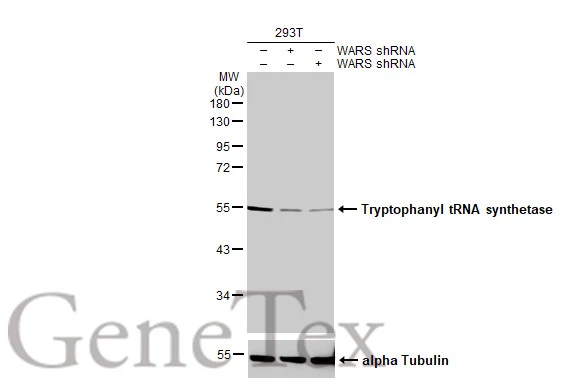 Non-transfected (–) and transfected (+) 293T whole cell extracts (30 μg) were separated by 10% SDS-PAGE, and the membrane was blotted with Tryptophanyl tRNA synthetase antibody [HL2186] (GTX638190) diluted at 1:1000. The HRP-conjugated anti-rabbit IgG antibody (GTX213110-01) was used to detect the primary antibody.