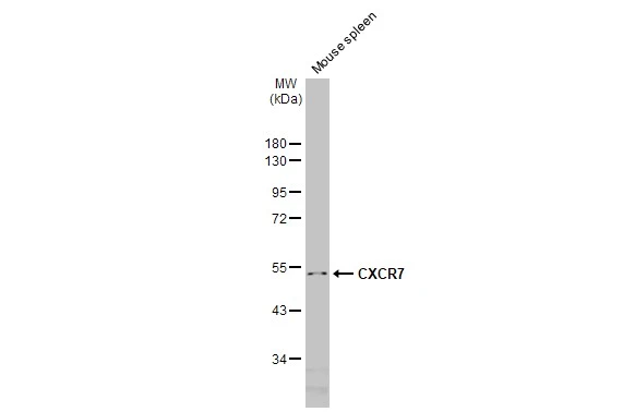 Mouse tissue extract (50 μg) was separated by 10% SDS-PAGE, and the membrane was blotted with CXCR7 antibody [HL2189] (GTX638193) diluted at 1:1000. The HRP-conjugated anti-rabbit IgG antibody (GTX213110-01) was used to detect the primary antibody.