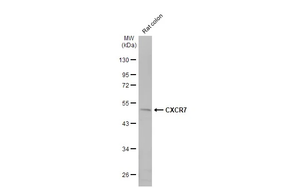 Rat tissue extract (50 μg) was separated by 10% SDS-PAGE, and the membrane was blotted with CXCR7 antibody [HL2189] (GTX638193) diluted at 1:1000. The HRP-conjugated anti-rabbit IgG antibody (GTX213110-01) was used to detect the primary antibody.