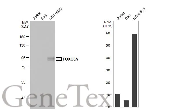 FOXO3A antibody [HL2190]