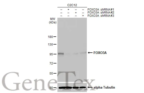 FOXO3A antibody [HL2190]