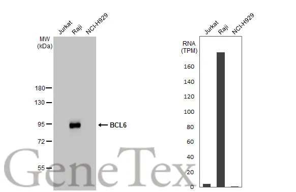 BCL6 antibody [HL2192]