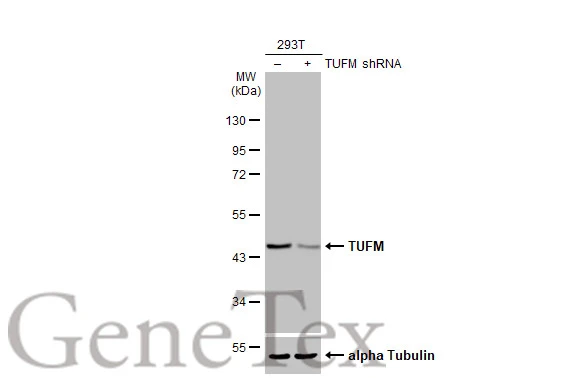 Non-transfected (–) and transfected (+) 293T whole cell extracts (30 μg) were separated by 10% SDS-PAGE, and the membrane was blotted with TUFM antibody [HL2193] (GTX638197) diluted at 1:1000. The HRP-conjugated anti-rabbit IgG antibody (GTX213110-01) was used to detect the primary antibody.
