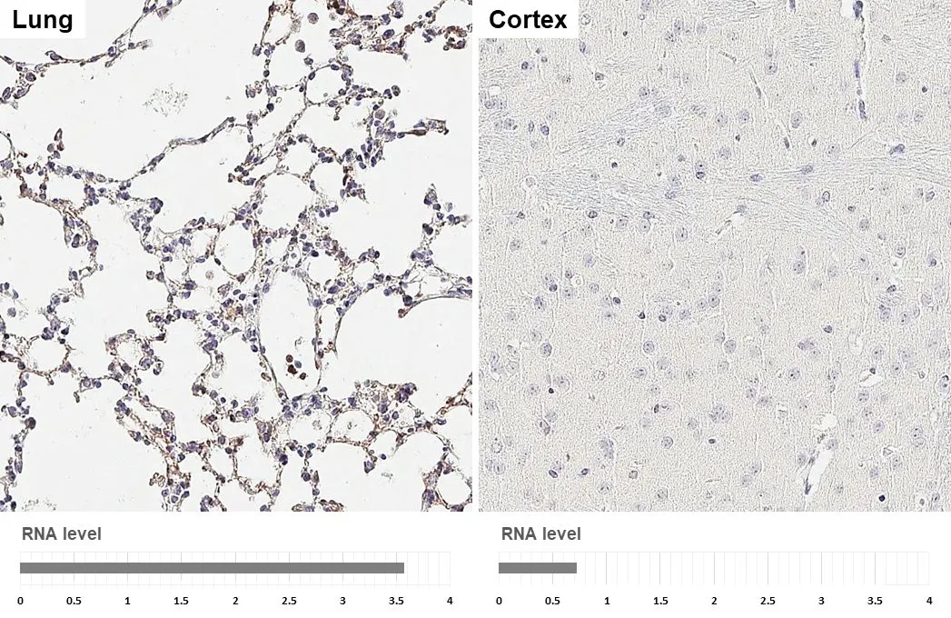 NPR-C antibody [HL2200] detects NPR-C protein by immunohistochemical analysis. Sample: Paraffin-embedded mouse tissues. NPR-C stained by NPR-C antibody [HL2200] (GTX638204) diluted at 1:100. Antigen Retrieval: Citrate buffer, pH 6.0, 15 min