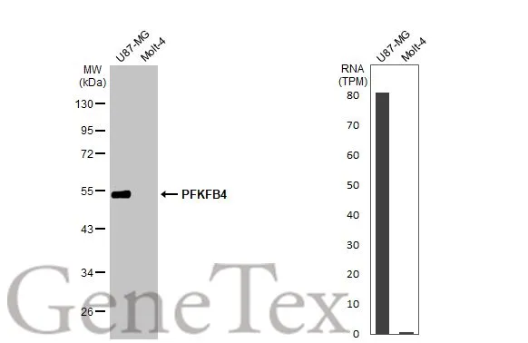 Various whole cell extracts (30 μg) were separated by 10% SDS-PAGE, and the membrane was blotted with PFKFB4 antibody [HL2204] (GTX638208) diluted at 1:1000. The HRP-conjugated anti-rabbit IgG antibody (GTX213110-01) was used to detect the primary antibody, and the signal was developed with Trident ECL plus-Enhanced. Corresponding RNA expression data for the same cell lines are based on Human Protein Atlas program.