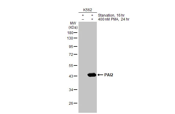Untreated (–) and treated (+) K562 whole cell extracts (30 μg) were separated by 10% SDS-PAGE, and the membrane was blotted with PAI2 antibody [HL2218] (GTX638222) diluted at 1:1000. The HRP-conjugated anti-rabbit IgG antibody (GTX213110-01) was used to detect the primary antibody.