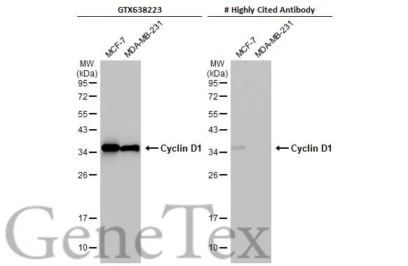 Various whole cell extracts (30 μg) were separated by 12% SDS-PAGE, and the membranes were blotted with Cyclin D1 antibody [HL2219] (GTX638223) diluted at 1:1000 and competitor's antibody (#Highly competitor antibody) diluted at 1:1000. The HRP-conjugated anti-rabbit IgG antibody (GTX213110-01) was used to detect the primary antibody. *The competitor is not affiliated with GeneTex and does not endorse this product.