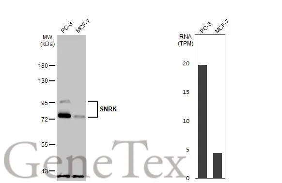 Various whole cell extracts (30 μg) were separated by 7.5% SDS-PAGE, and the membrane was blotted with SNRK antibody [HL2225] (GTX638270) diluted at 1:1000. The HRP-conjugated anti-rabbit IgG antibody (GTX213110-01) was used to detect the primary antibody. Corresponding RNA expression data for the same cell lines are based on Human Protein Atlas program.