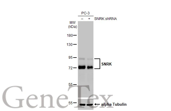 Non-transfected (–) and transfected (+) PC-3 whole cell extracts (30 μg) were separated by 7.5% SDS-PAGE, and the membrane was blotted with SNRK antibody [HL2225] (GTX638270) diluted at 1:1000. The HRP-conjugated anti-rabbit IgG antibody (GTX213110-01) was used to detect the primary antibody, and the signal was developed with Trident ECL plus-Enhanced.