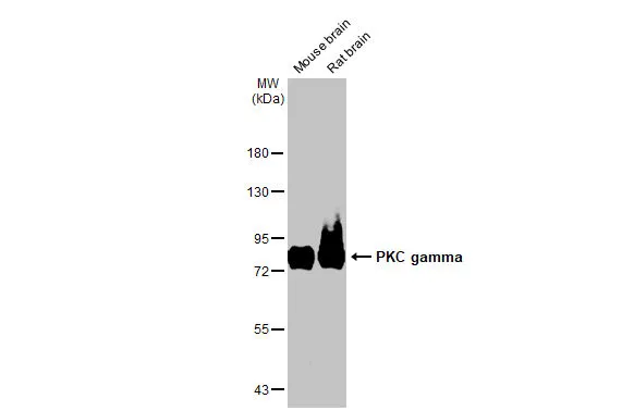 Various tissue extracts (50 μg) were separated by 7.5% SDS-PAGE, and the membrane was blotted with PKC gamma antibody [HL2226] (GTX638271) diluted at 1:5000. The HRP-conjugated anti-rabbit IgG antibody (GTX213110-01) was used to detect the primary antibody.