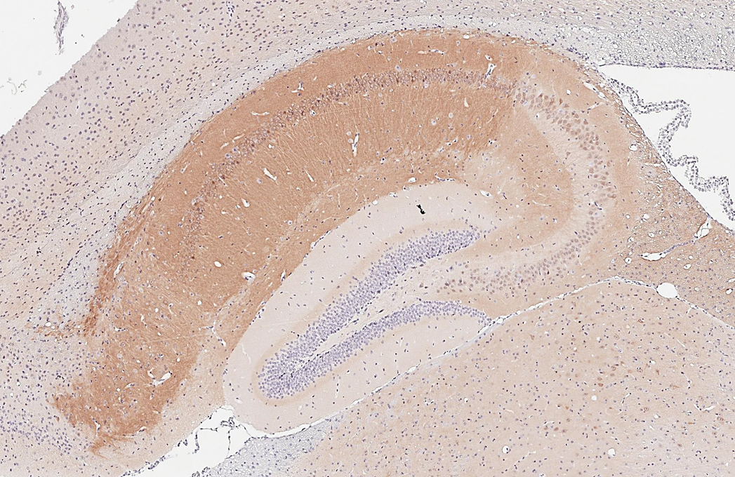 PKC gamma antibody [HL2226] detects PKC gamma protein by immunohistochemical analysis. Sample: Paraffin-embedded mouse hippocampus. PKC gamma stained by PKC gamma antibody [HL2226] (GTX638271) diluted at 1:1000. Antigen Retrieval: Citrate buffer, pH 6.0, 15 min
