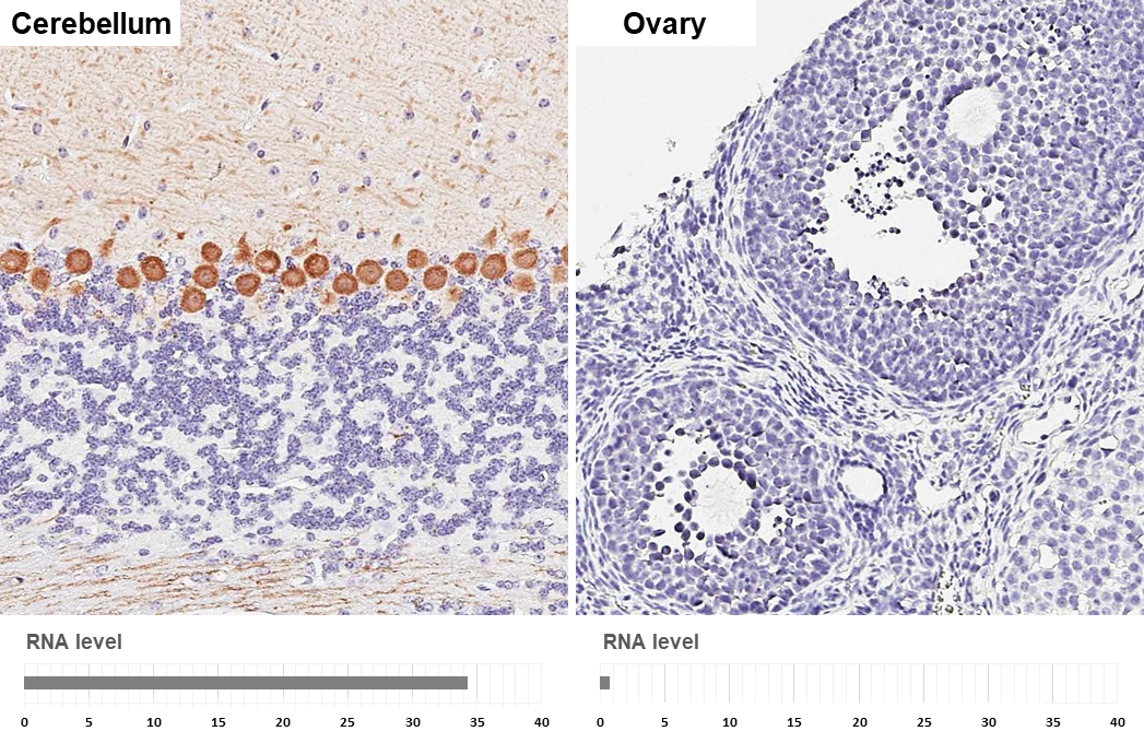 PKC gamma antibody [HL2226] detects PKC gamma protein by immunohistochemical analysis. Sample: Paraffin-embedded mouse tissues. PKC gamma stained by PKC gamma antibody [HL2226] (GTX638271) diluted at 1:1000. Antigen Retrieval: Citrate buffer, pH 6.0, 15 min