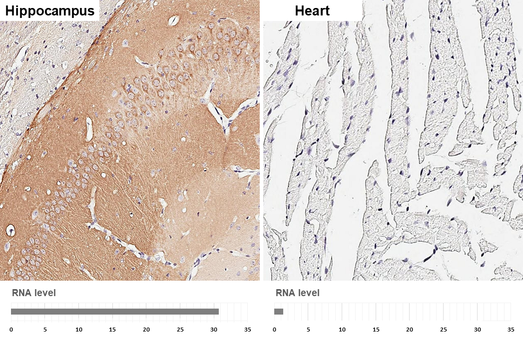 PKC gamma antibody [HL2226] detects PKC gamma protein by immunohistochemical analysis. Sample: Paraffin-embedded mouse tissues. PKC gamma stained by PKC gamma antibody [HL2226] (GTX638271) diluted at 1:1000. Antigen Retrieval: Citrate buffer, pH 6.0, 15 min