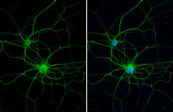 PKC gamma antibody [HL2227] detects PKC gamma protein at neurite by immunofluorescent analysis. Sample: DIV9 rat E18 primary hippocampal neuron cells were fixed in 4% paraformaldehyde at RT for 15 min. Green: PKC gamma stained by PKC gamma antibody [HL2227] (GTX638272) diluted at 1:250. Blue: Fluoroshield with DAPI (GTX30920).