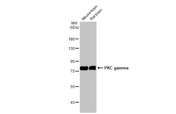 Various tissue extracts (50 μg) were separated by 7.5% SDS-PAGE, and the membrane was blotted with PKC gamma antibody [HL2227] (GTX638272) diluted at 1:5000. The HRP-conjated anti-rabbit IgG antibody (GTX213110-01) was used to detect the primary antibody.