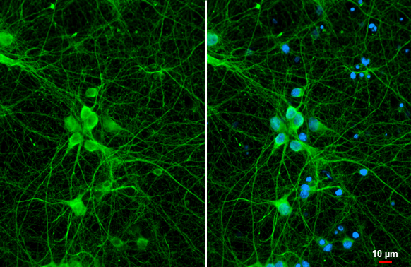 Anti-S100 beta antibody [HL2228] (GTX638273) | GeneTex