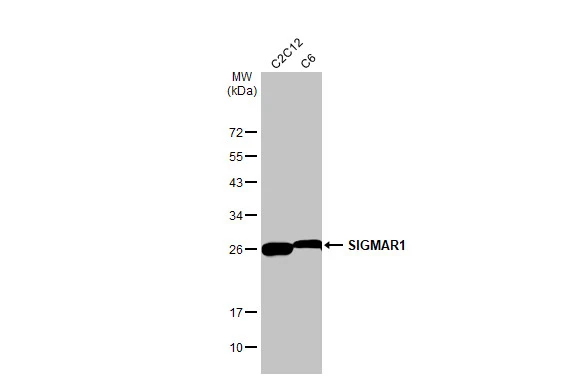Various whole cell extracts (30 μg) were separated by 12% SDS-PAGE, and the membrane was blotted with SIGMAR1 antibody [HL2230] (GTX638275) diluted at 1:1000. The HRP-conjugated anti-rabbit IgG antibody (GTX213110-01) was used to detect the primary antibody.