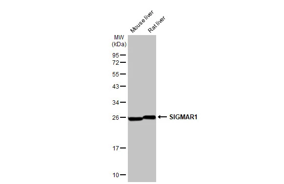Various tissue extracts (50 μg) were separated by 12% SDS-PAGE, and the membrane was blotted with SIGMAR1 antibody [HL2230] (GTX638275) diluted at 1:1000. The HRP-conjugated anti-rabbit IgG antibody (GTX213110-01) was used to detect the primary antibody.