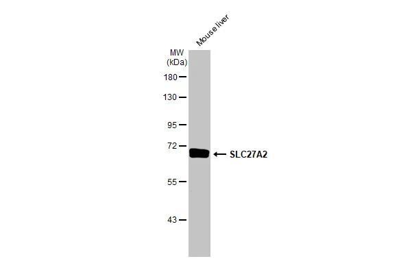 Mouse tissue extract (50 μg) was separated by 7.5% SDS-PAGE, and the membrane was blotted with SLC27A2 antibody [HL2232] (GTX638277) diluted at 1:1000. The HRP-conjugated anti-rabbit IgG antibody (GTX213110-01) was used to detect the primary antibody.