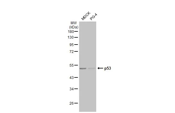 Various whole cell extracts (30 μg) were separated by 10% SDS-PAGE, and the membrane was blotted with p53 antibody [HL2242] (GTX638291) diluted at 1:1000. The HRP-conjugated anti-rabbit IgG antibody (GTX213110-01) was used to detect the primary antibody, and the signal was developed with Trident ECL plus-Enhanced.
