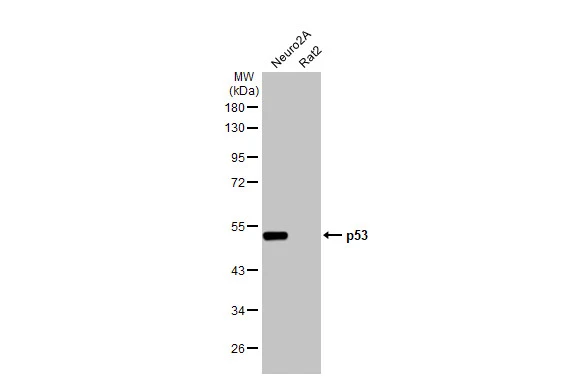 Various whole cell extracts (30 μg) were separated by 10% SDS-PAGE, and the membrane was blotted with p53 antibody [HL2242] (GTX638291) diluted at 1:1000. The HRP-conjugated anti-rabbit IgG antibody (GTX213110-01) was used to detect the primary antibody.