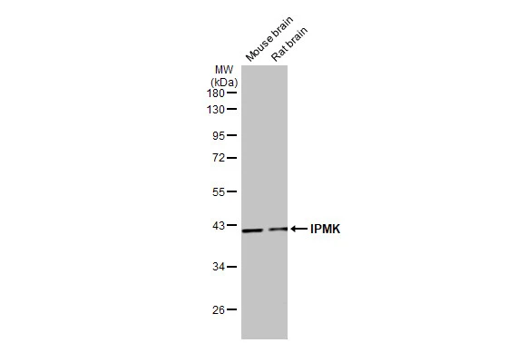 Various tissue extracts (50 μg) were separated by 10% SDS-PAGE, and the membrane was blotted with IPMK antibody [HL2244] (GTX638293) diluted at 1:4000. The HRP-conjugated anti-rabbit IgG antibody (GTX213110-01) was used to detect the primary antibody.