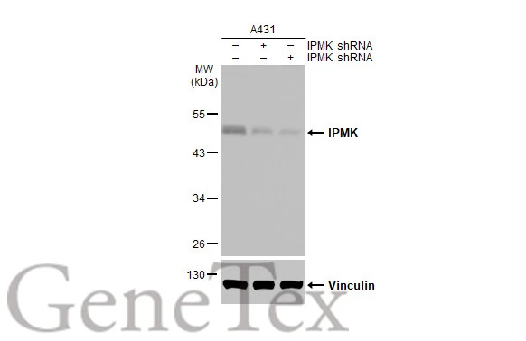 Non-transfected (–) and transfected (+) A431 whole cell extracts (30 μg) were separated by 10% SDS-PAGE, and the membrane was blotted with IPMK antibody [HL2244] (GTX638293) diluted at 1:4000. The HRP-conjugated anti-rabbit IgG antibody (GTX213110-01) was used to detect the primary antibody.