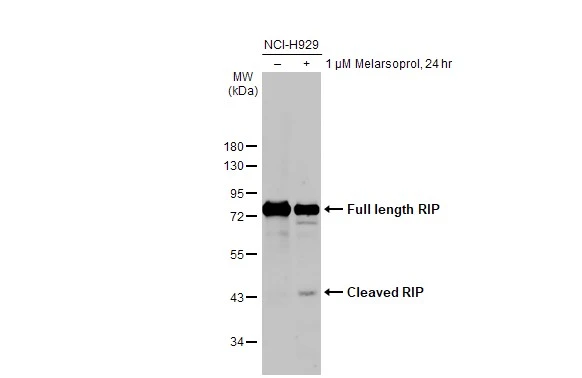 Untreated (–) and treated (+) NCI-H929 whole cell extract (30 μg) were separated by 10% SDS-PAGE, and the membrane was blotted with RIP antibody [HL2250] (GTX638299) diluted at 1:1000. The HRP-conjugated anti-rabbit IgG antibody (GTX213110-01) was used to detect the primary antibody, and the signal was developed with Trident ECL plus-Enhanced.