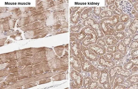 SDHB antibody [HL2251]