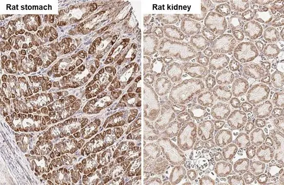 SDHB antibody [HL2251]