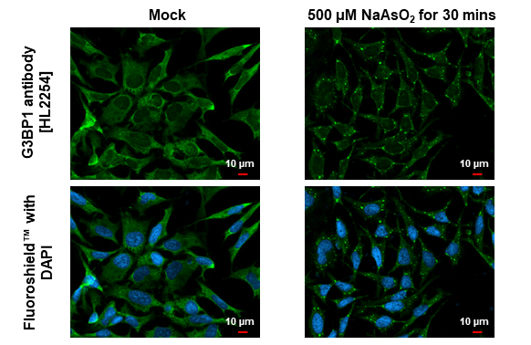 G3BP1 antibody [HL2254] detects G3BP1 protein at cytoplasm by immunofluorescent analysis. Sample: Mock and treated HeLa cells were fixed in ice-cold MeOH for 5 min. Green: G3BP1 stained by G3BP1 antibody [HL2254] (GTX638303) diluted at 1:500. Blue: Fluoroshield with DAPI (GTX30920).
