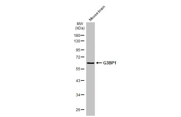 Mouse tissue extract (50 μg) was separated by 10% SDS-PAGE, and the membrane was blotted with G3BP1 antibody [HL2254] (GTX638303) diluted at 1:1000. The HRP-conjugated anti-rabbit IgG antibody (GTX213110-01) was used to detect the primary antibody.