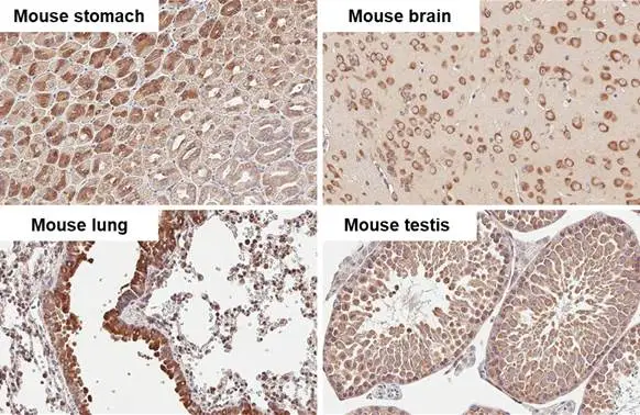 RPLP2 antibody [HL2256] detects RPLP2 protein by immunohistochemical analysis. Sample: Paraffin-embedded mouse tissues. RPLP2 stained by RPLP2 antibody [HL2256] (GTX638308) diluted at 1:100. Antigen Retrieval: Citrate buffer, pH 6.0, 15 min