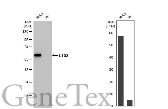 Various whole cell extracts (30 μg) were separated by 10% SDS-PAGE, and the membrane was blotted with ETS2 antibody [HL2258] (GTX638310) diluted at 1:2000. The HRP-conjugated anti-rabbit IgG antibody (GTX213110-01) was used to detect the primary antibody, and the signal was developed with Trident ECL plus-Enhanced. Corresponding RNA expression data for the same cell lines are based on Human Protein Atlas program.