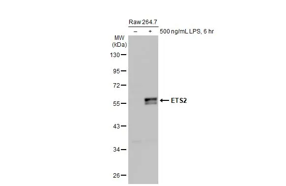 Untreated (–) and treated (+) Raw 264.7 whole cell extracts (30 μg) were separated by 10% SDS-PAGE, and the membrane was blotted with ETS2 antibody [HL2258] (GTX638310) diluted at 1:1000. The HRP-conjugated anti-rabbit IgG antibody (GTX213110-01) was used to detect the primary antibody, and the signal was developed with Trident ECL plus-Enhanced.