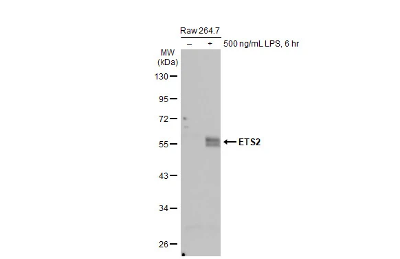 Untreated (–) and treated (+) Raw 264.7 whole cell extracts (30 μg) were separated by 10% SDS-PAGE, and the membrane was blotted with ETS2 antibody [HL2259] (GTX638311) diluted at 1:1000. The HRP-conjugated anti-rabbit IgG antibody (GTX213110-01) was used to detect the primary antibody, and the signal was developed with Trident ECL plus-Enhanced.