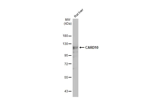 Rat tissue extract (50 μg) was separated by 7.5% SDS-PAGE, and the membrane was blotted with CARD10 antibody [HL2261] (GTX638313) diluted at 1:500. The HRP-conjugated anti-rabbit IgG antibody (GTX213110-01) was used to detect the primary antibody, and the signal was developed with Trident ECL plus-Enhanced.