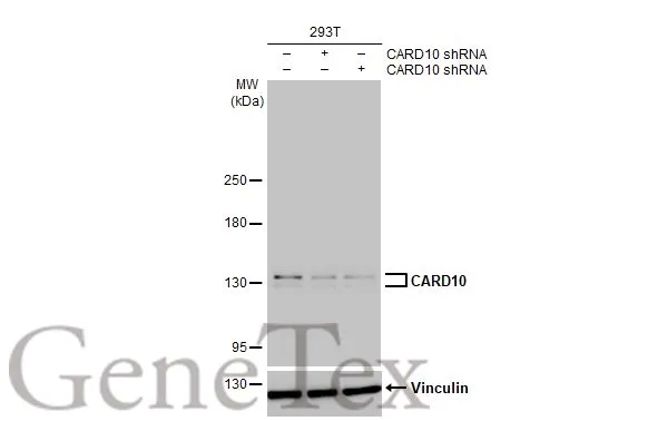 Non-transfected (–) and transfected (+) 293T whole cell extracts (30 μg) were separated by 5% SDS-PAGE, and the membrane was blotted with CARD10 antibody [HL2261] (GTX638313) diluted at 1:1000. The HRP-conjugated anti-rabbit IgG antibody (GTX213110-01) was used to detect the primary antibody, and the signal was developed with Trident ECL plus-Enhanced.