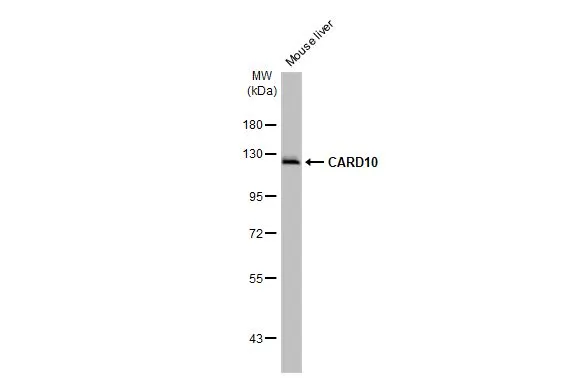 Anti-CARD10 antibody [HL2261] (GTX638313) | GeneTex