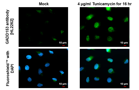GADD153 antibody [HL2262] detects GADD153 protein at cytoplasm and nucleus by immunofluorescent analysis. Sample: Mock and treated HeLa cells were fixed in 4% paraformaldehyde at RT for 15 min. Green: GADD153 stained by GADD153 antibody [HL2262] (GTX638314) diluted at 1:500. Blue: Fluoroshield with DAPI (GTX30920).