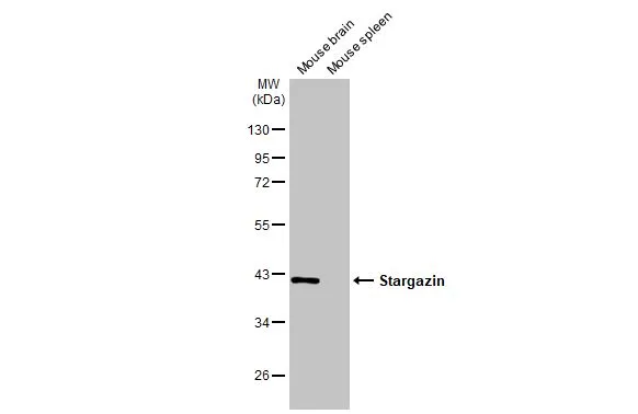 Stargazin antibody [HL2268]