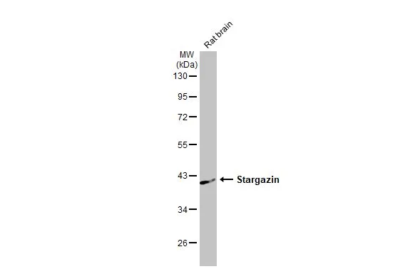 Stargazin antibody [HL2268]