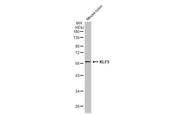 Mouse tissue extract (50 μg) was separated by 10% SDS-PAGE, and the membrane was blotted with KLF5 antibody [HL2269] (GTX638321) diluted at 1:1000. The HRP-conjugated anti-rabbit IgG antibody (GTX213110-01) was used to detect the primary antibody, and the signal was developed with Trident ECL plus-Enhanced.