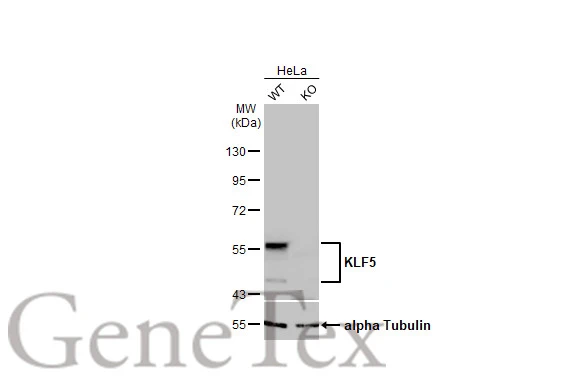 Wild-type (WT) and KLF5 knockout (KO) HeLa cell extracts (30 μg) were separated by 10% SDS-PAGE, and the membrane was blotted with KLF5 antibody [HL2269] (GTX638321) diluted at 1:1000. The HRP-conjugated anti-rabbit IgG antibody (GTX213110-01) was used to detect the primary antibody.