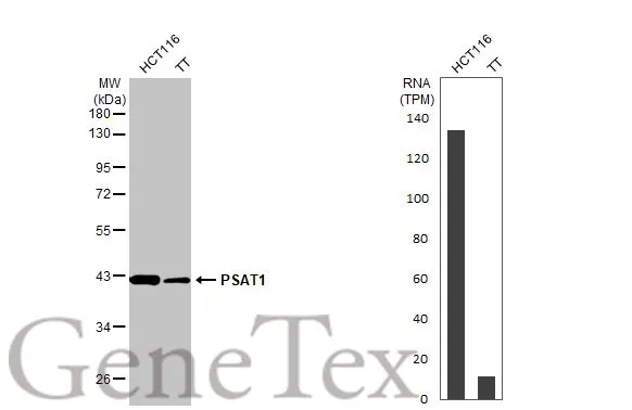 Various whole cell extracts (30 μg) were separated by 10% SDS-PAGE, and the membrane was blotted with PSAT1 antibody [HL2270] (GTX638322) diluted at 1:1000. The HRP-conjugated anti-rabbit IgG antibody (GTX213110-01) was used to detect the primary antibody. Corresponding RNA expression data for the same cell lines are based on Human Protein Atlas program.