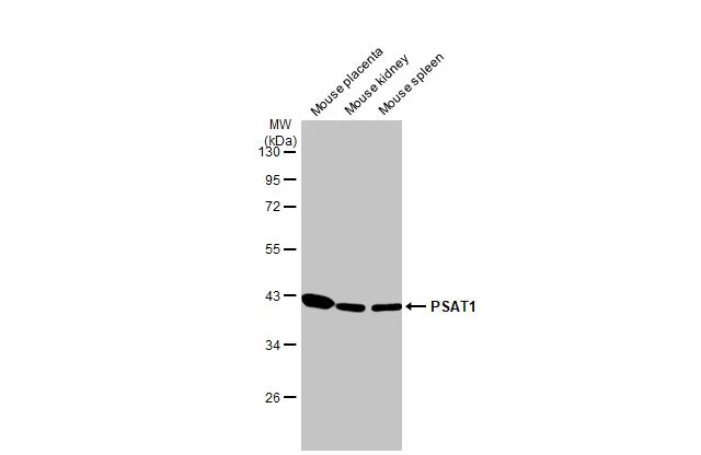 Various tissue extracts (50 μg) were separated by 10% SDS-PAGE, and the membrane was blotted with PSAT1 antibody [HL2270] (GTX638322) diluted at 1:1000. The HRP-conjugated anti-rabbit IgG antibody (GTX213110-01) was used to detect the primary antibody.